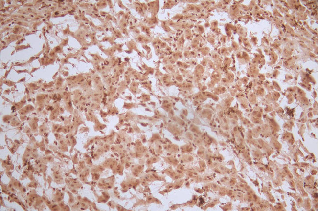 Ferritin Heavy Chain Antibody in Immunohistochemistry (Paraffin) (IHC (P))