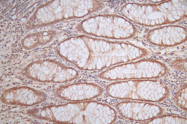 Ferritin Heavy Chain Antibody in Immunohistochemistry (Paraffin) (IHC (P))