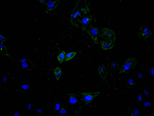 ATP7B Antibody in Immunocytochemistry (ICC/IF)