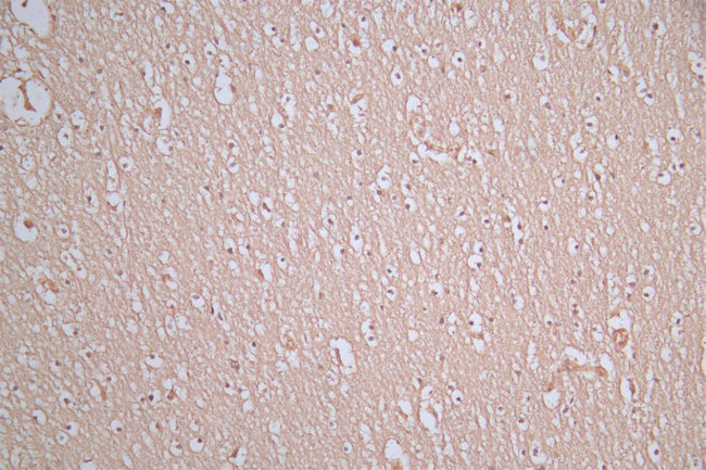 alpha Synuclein Antibody in Immunohistochemistry (Paraffin) (IHC (P))