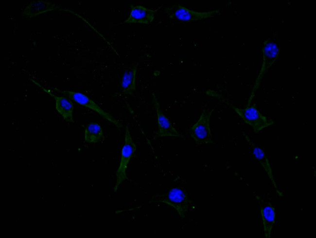 GFAP Antibody in Immunocytochemistry (ICC/IF)