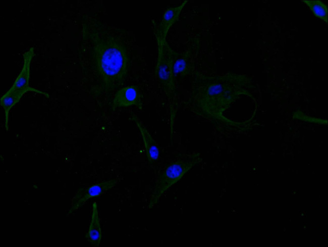 GFAP Antibody in Immunocytochemistry (ICC/IF)