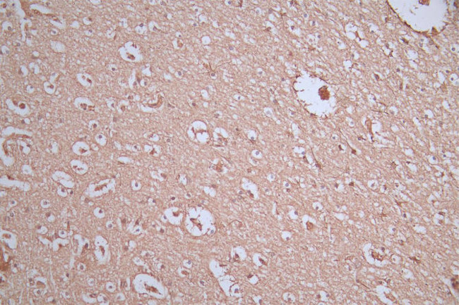 GFAP Antibody in Immunohistochemistry (Paraffin) (IHC (P))