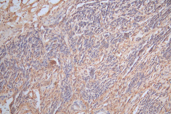 GFAP Antibody in Immunohistochemistry (Paraffin) (IHC (P))