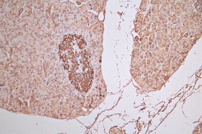 FGFR1 Antibody in Immunohistochemistry (Paraffin) (IHC (P))