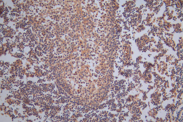 TK1 Antibody in Immunohistochemistry (Paraffin) (IHC (P))