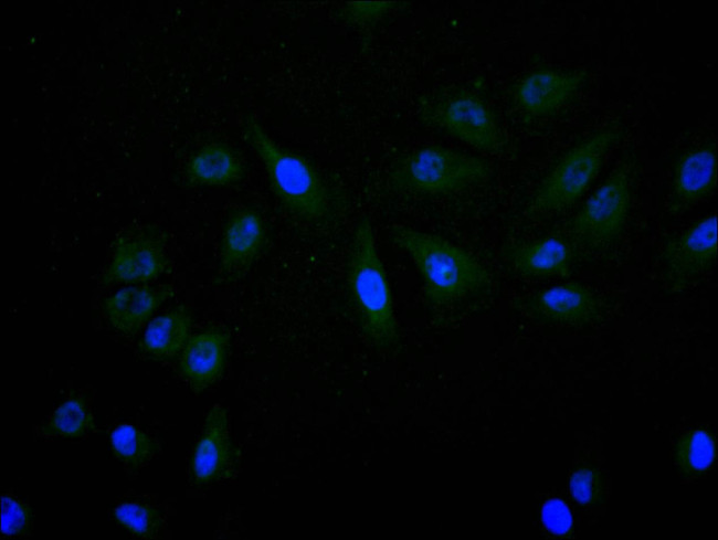 SNRPD1 Antibody in Immunocytochemistry (ICC/IF)