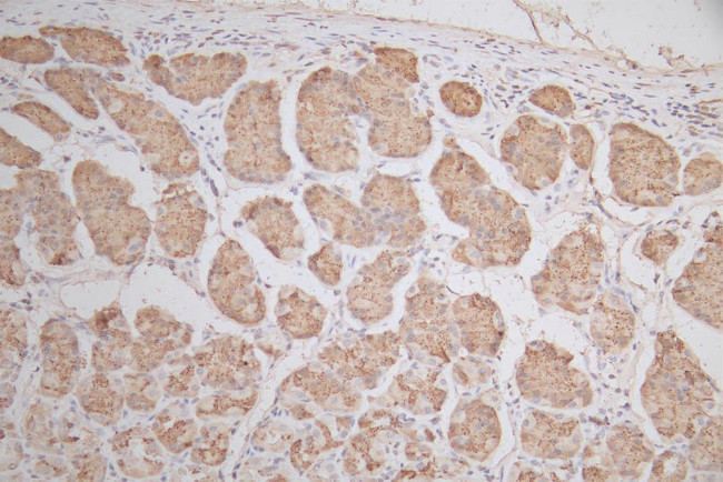 SNRPD1 Antibody in Immunohistochemistry (Paraffin) (IHC (P))