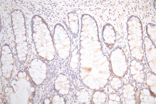 UBE2C Antibody in Immunohistochemistry (Paraffin) (IHC (P))