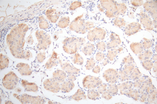 UBE2C Antibody in Immunohistochemistry (Paraffin) (IHC (P))