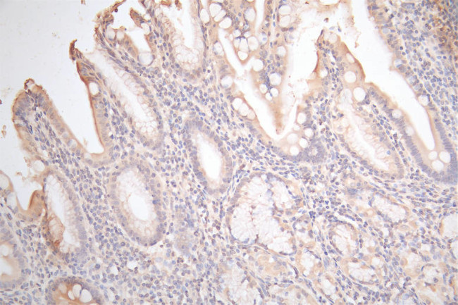 Connexin 26 Antibody in Immunohistochemistry (Paraffin) (IHC (P))