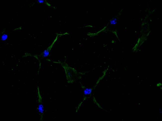 CD51 Antibody in Immunocytochemistry (ICC/IF)