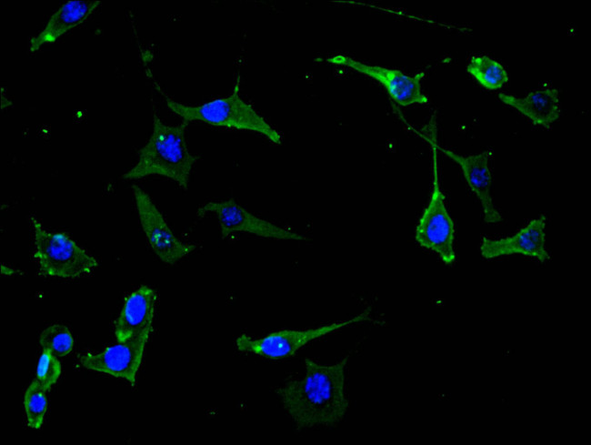 TrkB Antibody in Immunocytochemistry (ICC/IF)