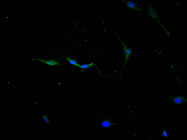 Cathepsin L Antibody in Immunocytochemistry (ICC/IF)