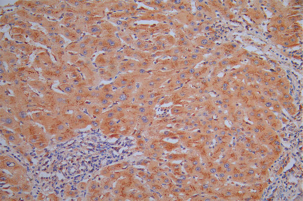 Cathepsin L Antibody in Immunohistochemistry (Paraffin) (IHC (P))