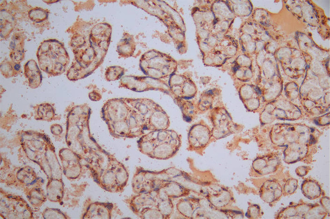 Cathepsin L Antibody in Immunohistochemistry (Paraffin) (IHC (P))