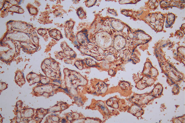 Calreticulin Antibody in Immunohistochemistry (Paraffin) (IHC (P))