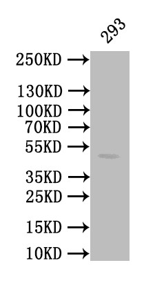 Calreticulin Antibody in Western Blot (WB)