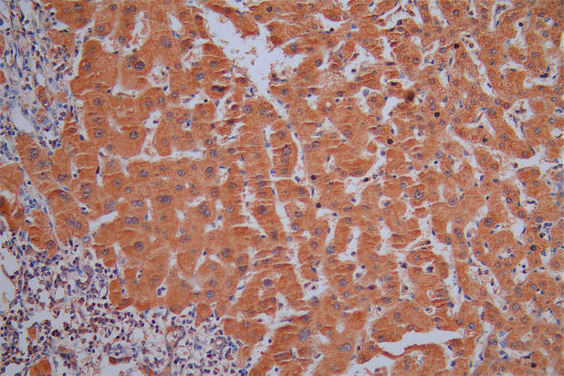 gamma Synuclein Antibody in Immunohistochemistry (Paraffin) (IHC (P))