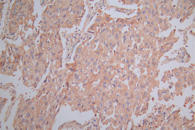 CRACC Antibody in Immunohistochemistry (Paraffin) (IHC (P))