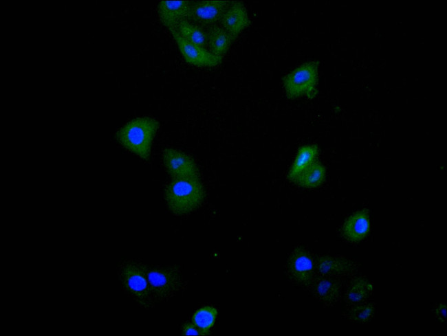 SOD1 Antibody in Immunocytochemistry (ICC/IF)