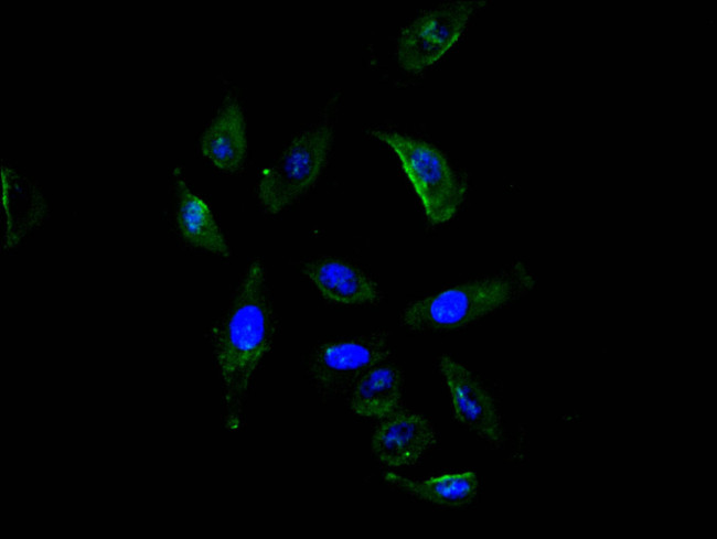 ROBO1 Antibody in Immunocytochemistry (ICC/IF)