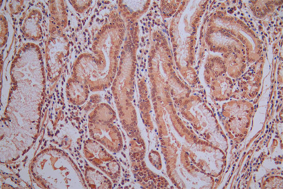 ROBO1 Antibody in Immunohistochemistry (Paraffin) (IHC (P))