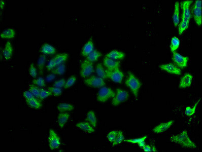 CD273 (B7-DC) Antibody in Immunocytochemistry (ICC/IF)