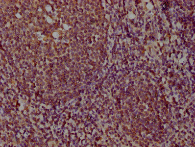 CD273 (B7-DC) Antibody in Immunohistochemistry (Paraffin) (IHC (P))