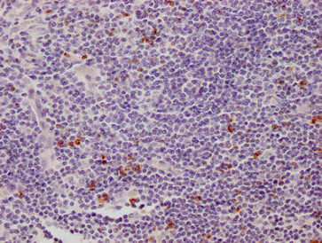 CD223 Antibody in Immunohistochemistry (Paraffin) (IHC (P))