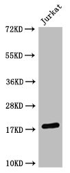 H3K4me2 Antibody in Western Blot (WB)