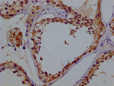 GSTM3 Antibody in Immunohistochemistry (Paraffin) (IHC (P))