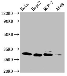 GSTM3 Antibody in Western Blot (WB)