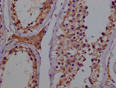 GSTM3 Antibody in Immunohistochemistry (Paraffin) (IHC (P))