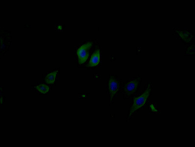 Phospho-PERK (Thr981) Antibody in Immunocytochemistry (ICC/IF)