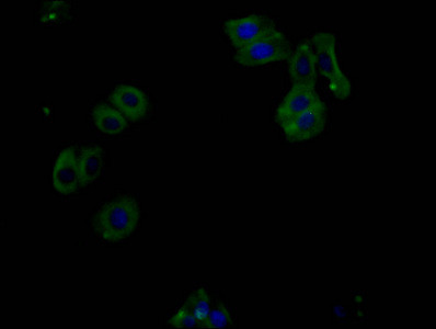 Phospho-PERK (Thr981) Antibody in Immunocytochemistry (ICC/IF)