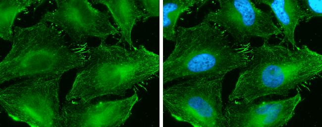 beta Catenin Antibody in Immunocytochemistry (ICC/IF)