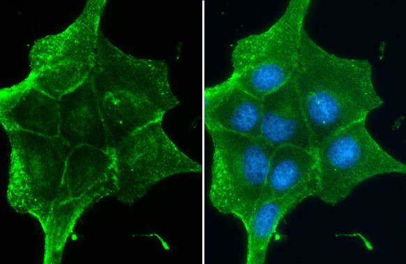 beta Catenin Antibody in Immunocytochemistry (ICC/IF)