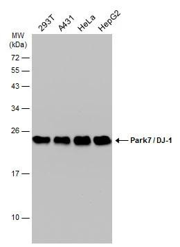 DJ-1 Antibody in Western Blot (WB)