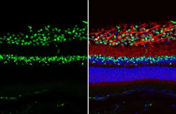 PAX6 Antibody in Immunohistochemistry (Paraffin) (IHC (P))