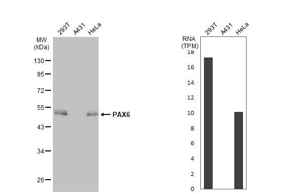 PAX6 Antibody in Western Blot (WB)