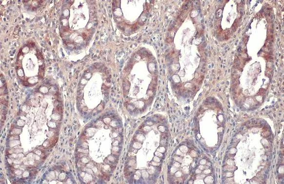 Galectin 3 Antibody in Immunohistochemistry (Paraffin) (IHC (P))