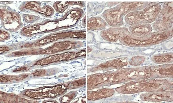 ACE2 Antibody in Immunohistochemistry (Paraffin) (IHC (P))