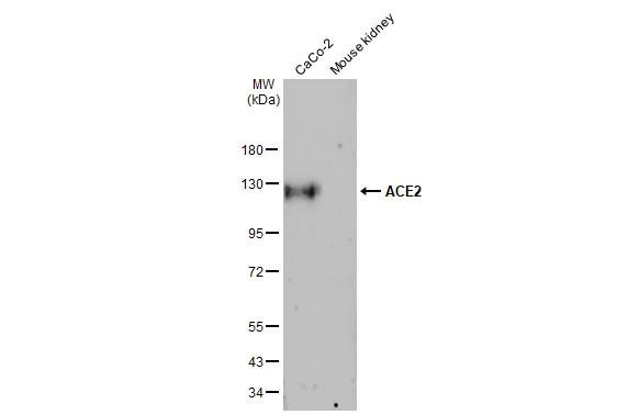 ACE2 Antibody in Western Blot (WB)