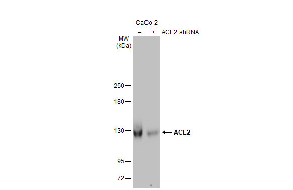 ACE2 Antibody in Western Blot (WB)