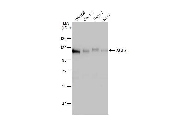 ACE2 Antibody in Western Blot (WB)