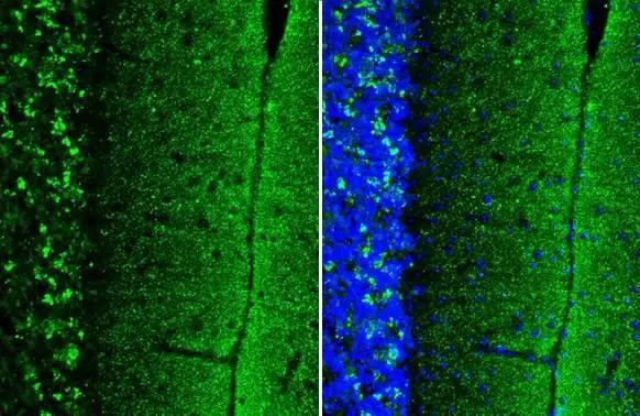 alpha Synuclein Antibody in Immunohistochemistry (Frozen) (IHC (F))