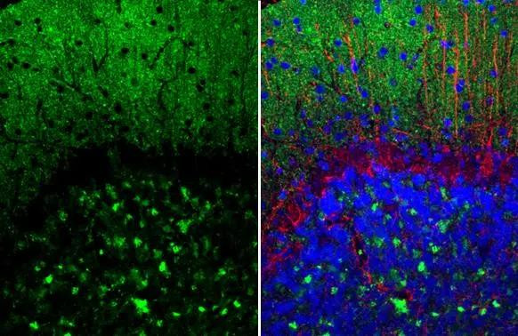 alpha Synuclein Antibody in Immunohistochemistry (Paraffin) (IHC (P))