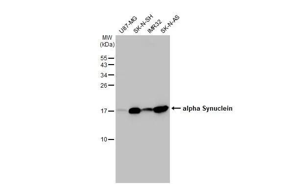 alpha Synuclein Antibody in Western Blot (WB)