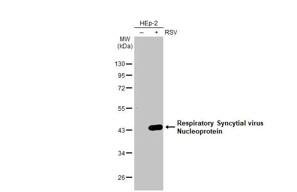 RSV NP Antibody in Western Blot (WB)